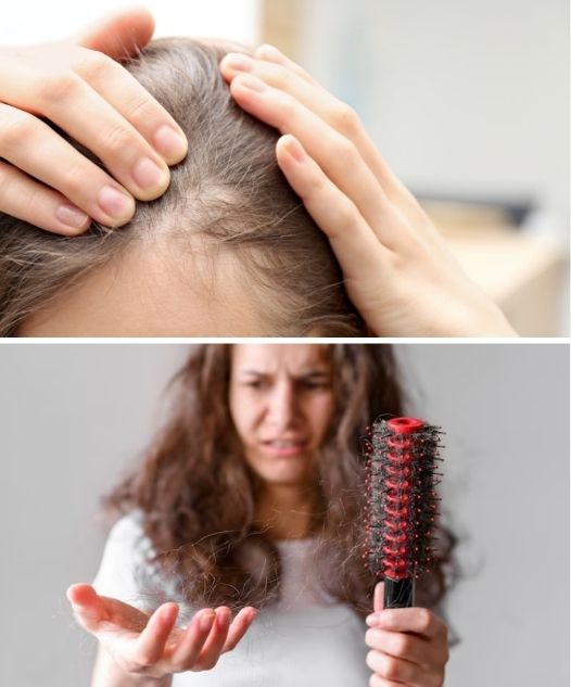 5 Passos Eficazes para Evitar a Queda de Cabelo